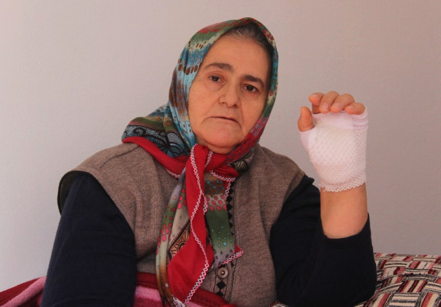 Tomografi Çektirmeye Gitti Elinden Oluyordu